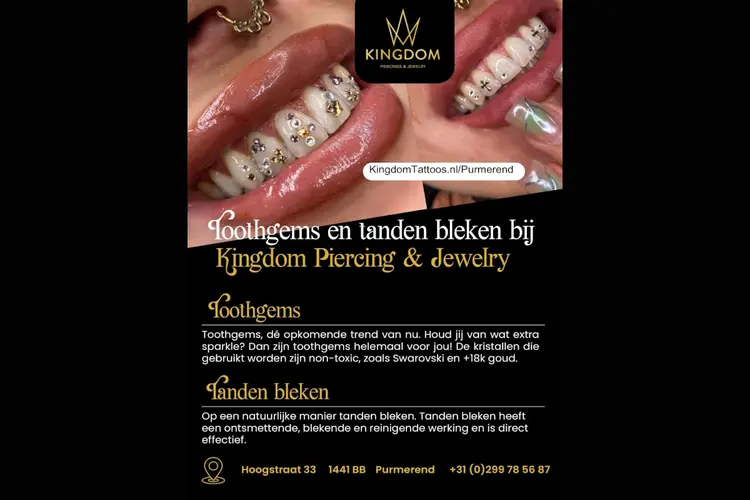 Nieuw bij Kingdom Piercings & Jewelry: Toothgems